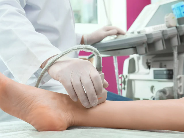 Doppler Vascular Periferico