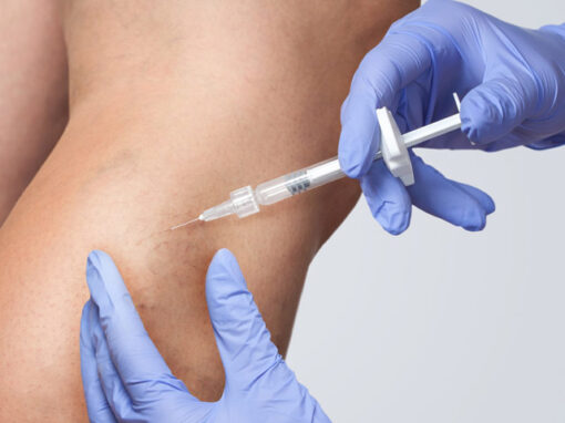 Escleroterapia_1