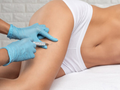 Escleroterapia_2