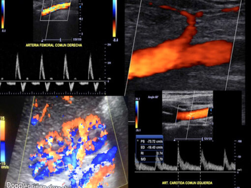ultrasonido_doppler_vascular